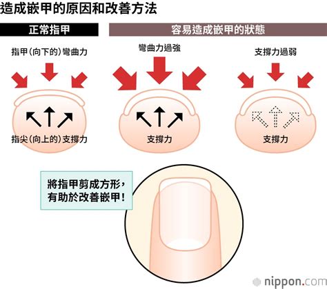 正常指甲長度|如何正確修剪指甲？日本專家：最好修剪成方形、每五。